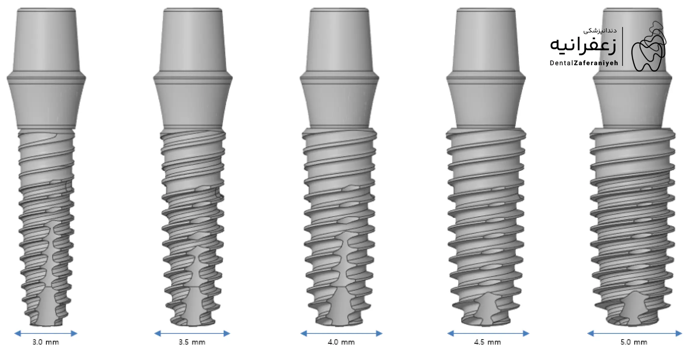 انواع ایمپلنت دندان بر اساس طول و قطر