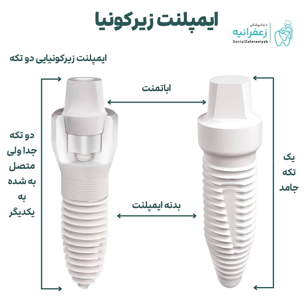 ایمپلنت دندان زیرکونیایی