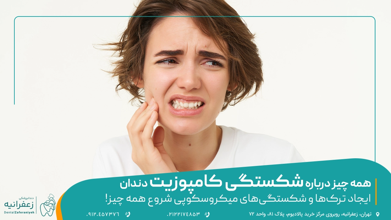 🦷 همه چیز درباره شکستگی کامپوزیت دندان 🩹