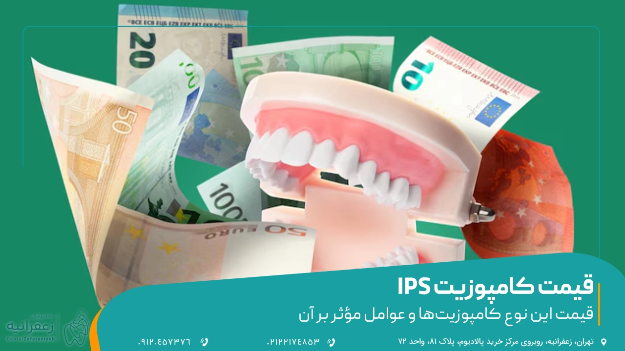 PRICE کامپوزیت ای پی اس