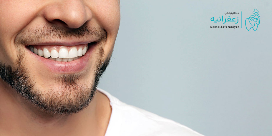 ایمپلنت دندان چیست؟ انواع ایمپلنت دندان